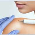 Trusted Dermatology Care For Mole Removal And Evaluation