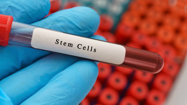 Dubai, Health, Stem Cell Treatment Dubai | Synergy Medical