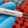 Stem Cell Treatment Dubai | Synergy Medical