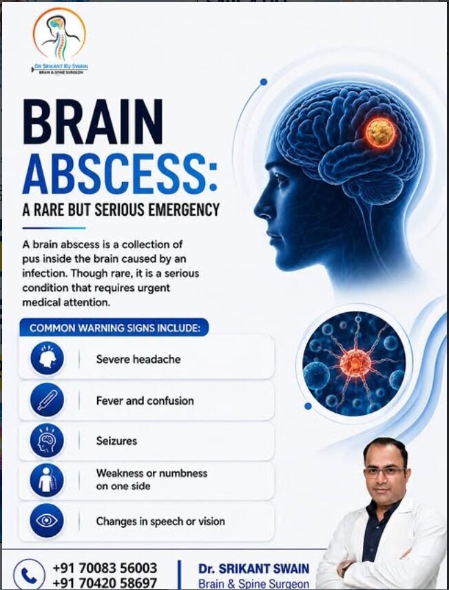 Mumbai, Health, Brain Abscess & Serious Brain Complications | Dr. Srikant Swain
