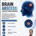 Brain Abscess & Serious Brain Complications | Dr. Srikant Swain