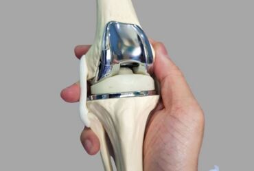 New Delhi, Health, Knee Replacement In East Delhi