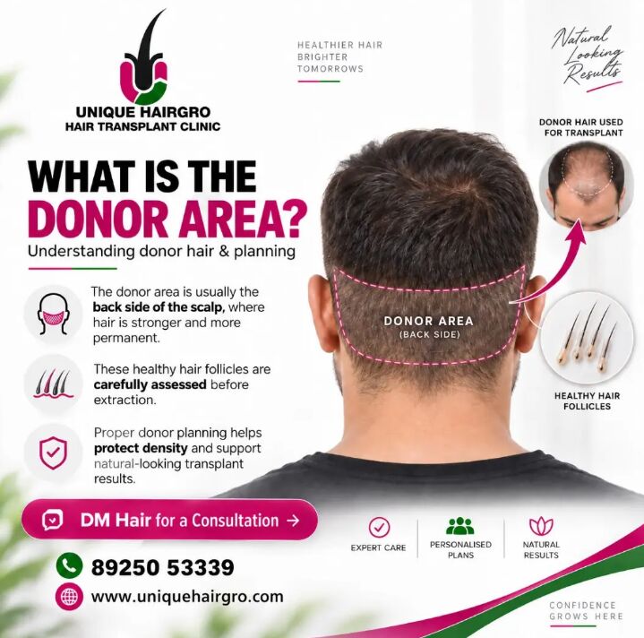 Chennai, Health, Hair Transplant Clinic In Chennai