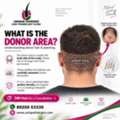 Hair Transplant Clinic In Chennai