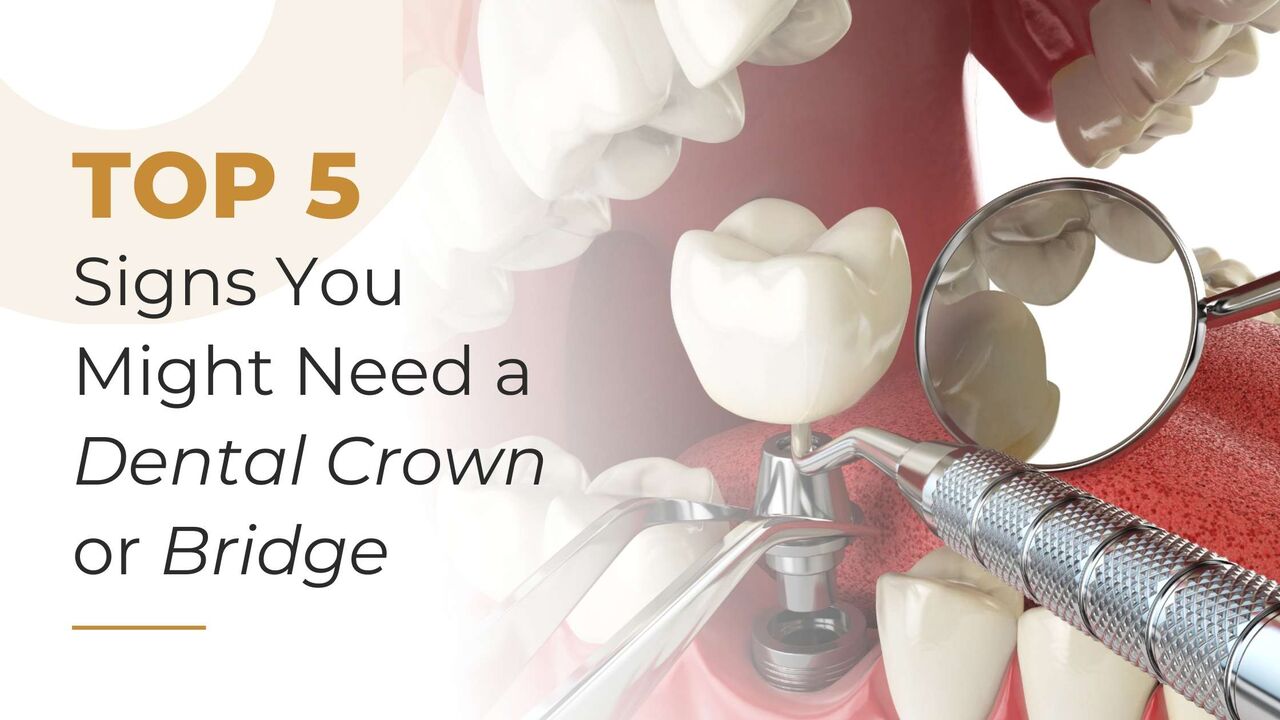 Bangalore, Dental, Dental Crown And Bridge