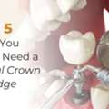 Dental Crown And Bridge