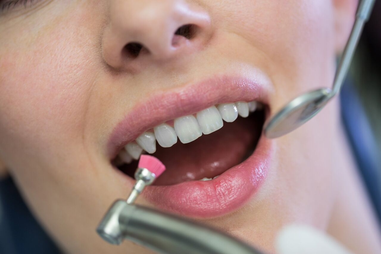 Mississauga, Dental, Get A Complete Smile Transformation In Mississauga