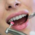 Get A Complete Smile Transformation In Mississauga