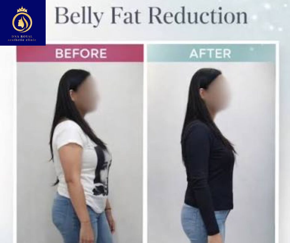 Thane, Fashion & Design, Best Slimming Treatment In Thane For A Healthier You | DNA Royal.
