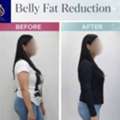 Best Slimming Treatment In Thane For A Healthier You | DNA Royal.