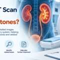 Can A CT Scan Detect Kidney Stones?