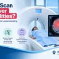 Can A CT Scan Detect Liver Abnormalities?