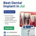 Dental Implants In Jui | Triveni Dental