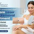 Tired Of Unwanted Hair? Explore Laser Hair Removal Treatment