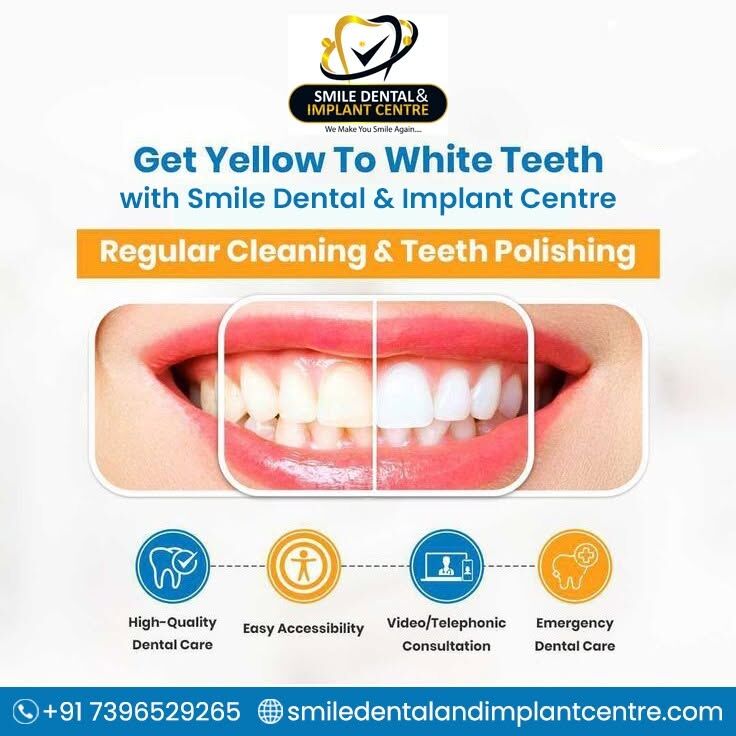 Hyderabad, Dental, Affordable Teeth Cleaning In Hyderabad &ndash; Smile Dental And Implant Centre