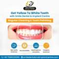 Affordable Teeth Cleaning In Hyderabad &ndash; Smile Dental And Implant Centre