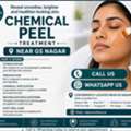 INR 2000,  Concerned About Pigmentation Or Acne Marks Near GS Nagar?