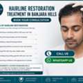 INR 30000,  Considering Hairline Restoration Treatment In Banjara Hills?
