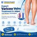 Expert Varicose Veins Treatment In Jaipur With Modern Techniquesv