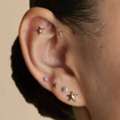 Where Can You Get Professional Earlobe Repair In Mumbai?