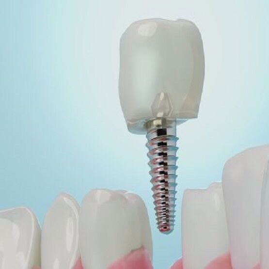 London, Health, Direct Dental Clapham