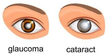 New Delhi, Health, Need Glaucoma Treatment In Delhi? Book Your Eye Consultation Today