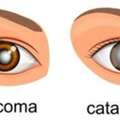 Need Glaucoma Treatment In Delhi? Book Your Eye Consultation Today