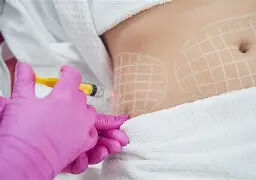 Toronto, Beautician, Fat Dissolving Injections On Stomach &ndash; Non-Surgical Body Contouring