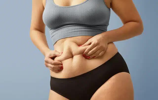 New Delhi, Health, Tummy Tuck Surgery In Delhi - Dr Rajat Gupta