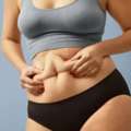 Tummy Tuck Surgery In Delhi - Dr Rajat Gupta