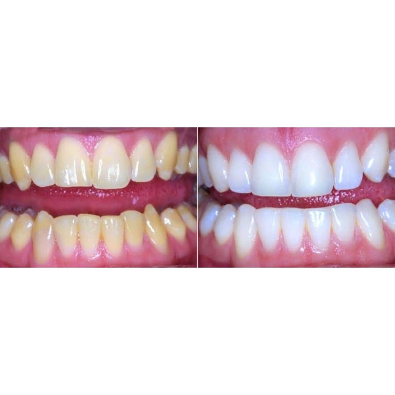Toronto, Business, Dental Cleaning Orangeville