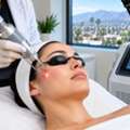 CO2 Laser In Covina, CA