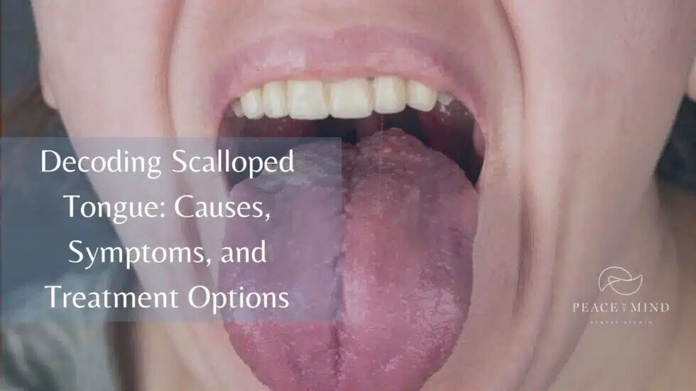 New York, Health, What Is A Scalloped Tongue And What Could Be Causing It?