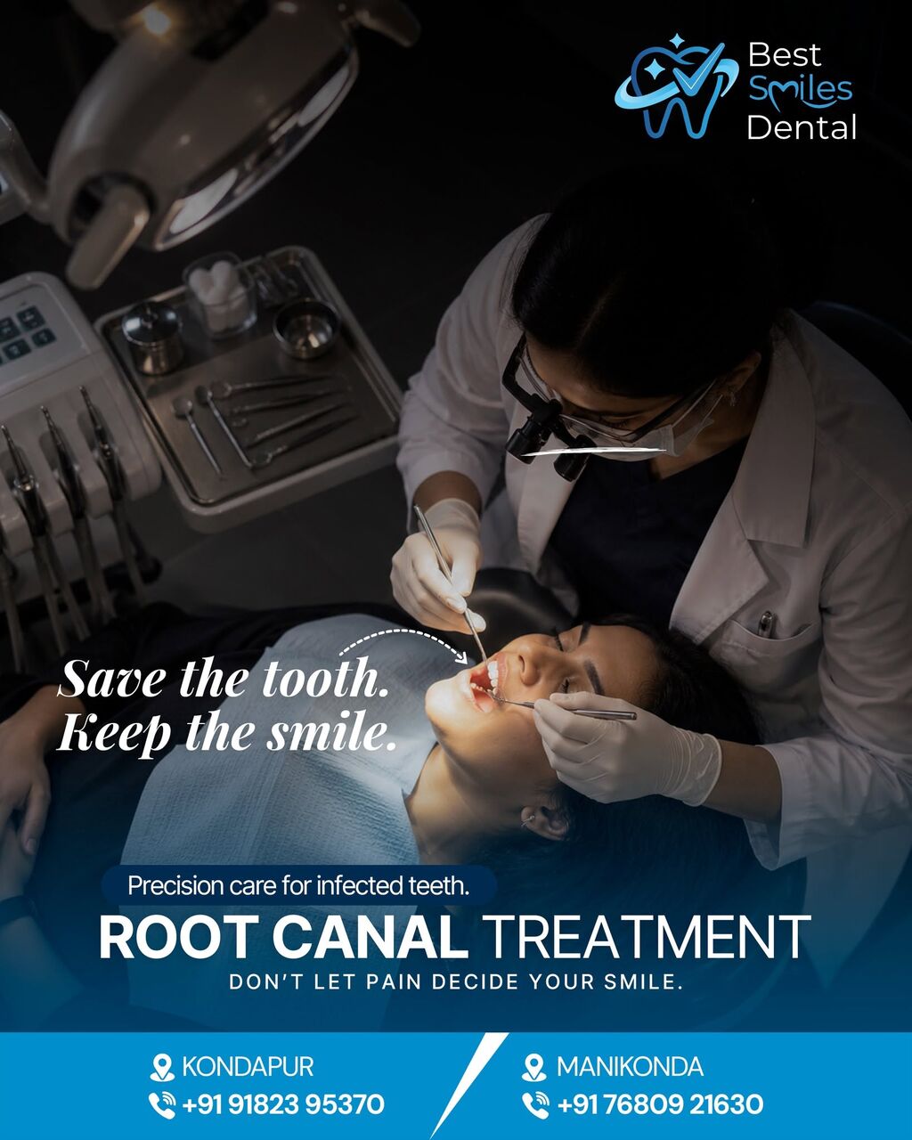 Hyderabad, Dental, Root Canal Treatment In Kondapur, Hyderabad - Best Smiles Dental Clinic