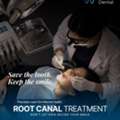 Root Canal Treatment In Kondapur, Hyderabad - Best Smiles Dental Clinic