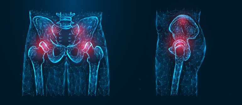 Sydney, Health, Total Hip Replacement Surgery Albury | Hip Joint Treatment