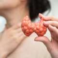 Thyroid Surgery In Bhagalpur Bihar For Specialized Care