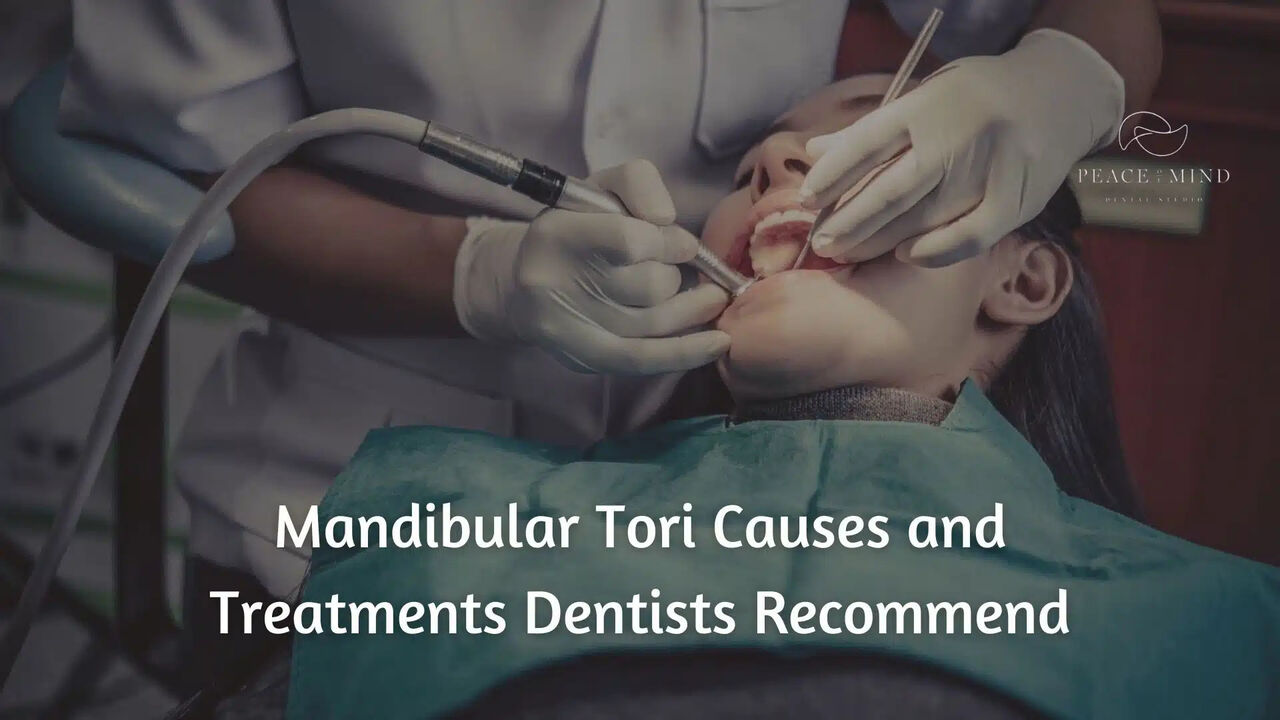 New York, Health, Hard Bony Bumps Along Your Lower Jaw? You May Have Mandibular Tori