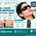 INR 3000,  Facial Hair Laser Removal Near Civil Lines Jaipur