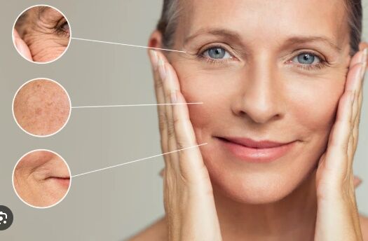 New York, Beautician, Exploring Non Surgical Options For Wrinkle Care