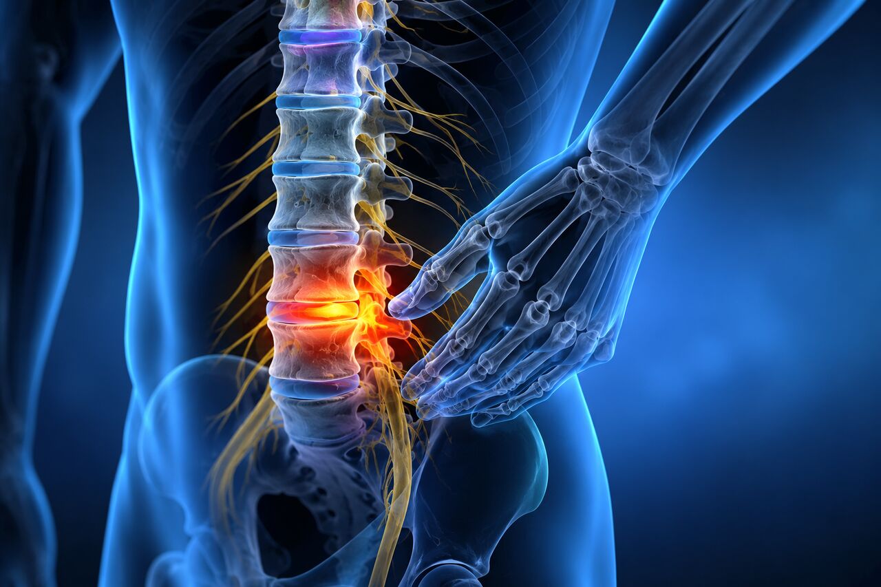 New York, Health, Pinched Nerve Neck Treatment Without Surgery