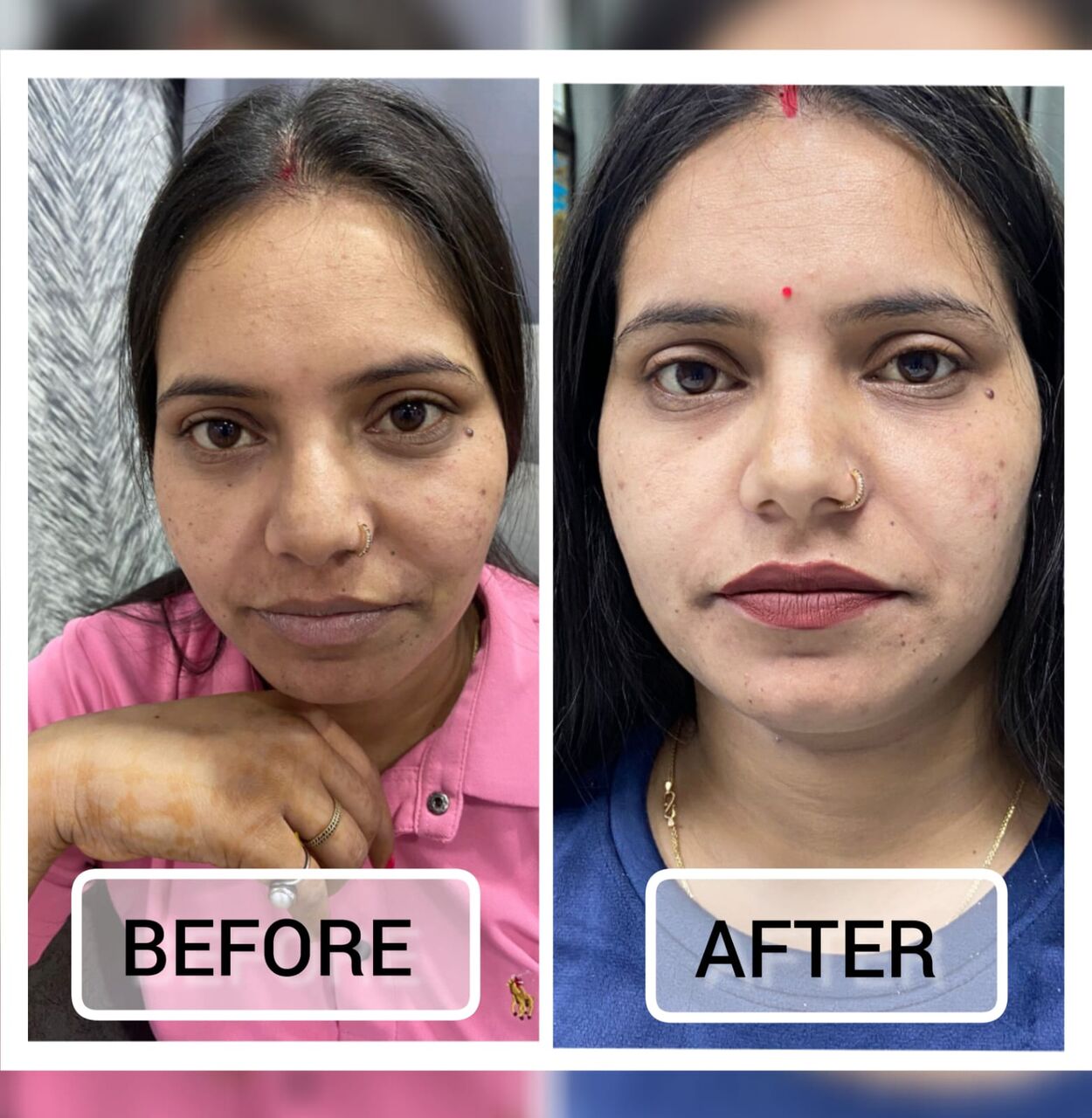 New Delhi, Health, Skin Care Clinic In Delhi