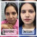 Skin Care Clinic In Delhi