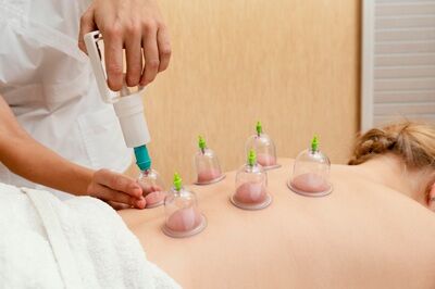 London, Business, Cupping Therapy Eastleigh &ndash; Natural Wellness Support