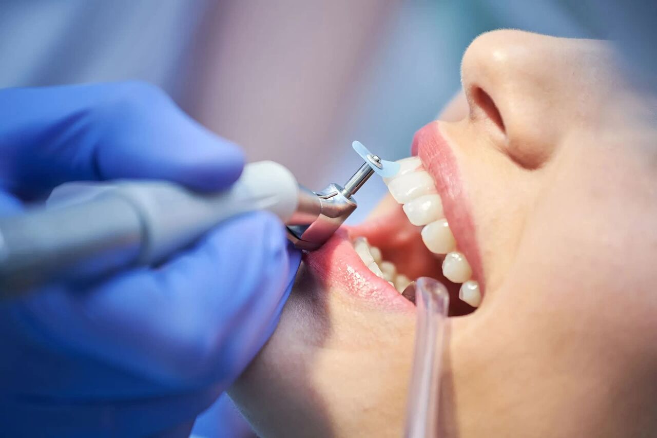 New York, Dental, Professional Gum Care Support For Deep Teeth Cleaning Near Me