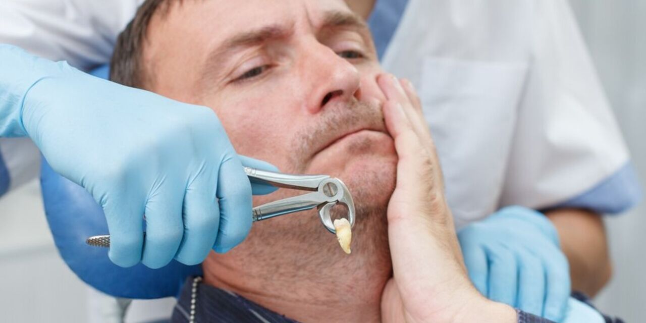 Washington DC, Dental, Get Professional Help For An Unexpected Tooth Problem In Issaquah