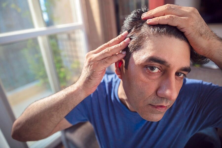 Pune, Business, QR678 Hair Loss Treatment In Pune: What To Know