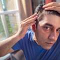 QR678 Hair Loss Treatment In Pune: What To Know