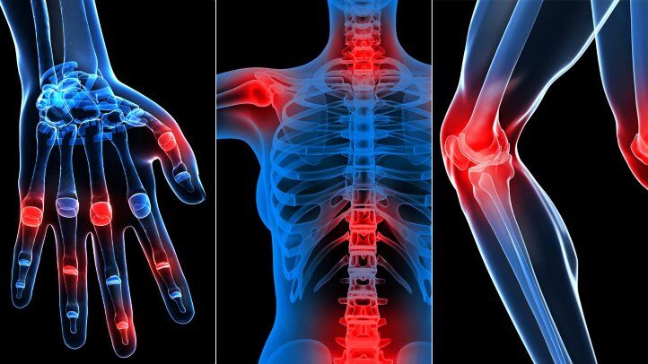 Hyderabad, Health, Pediatric Rheumatology Specialist &ndash; Hyderabad