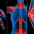 Pediatric Rheumatology Specialist &ndash; Hyderabad
